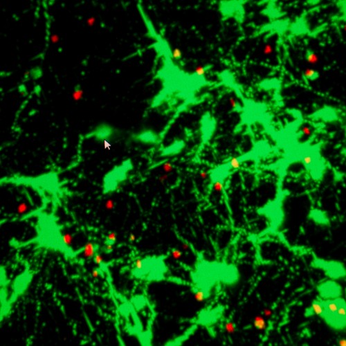 Scan of brain with a concussion