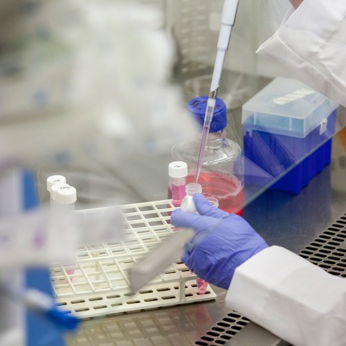 Lab tech using pipette and specimen samples